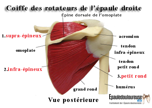 coiffe des rotateurs de l'épaule droite