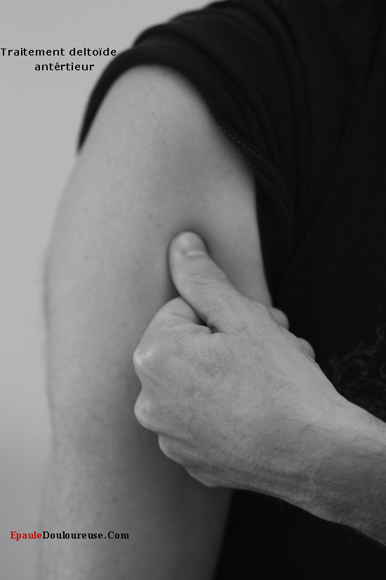 prudence points gâchettes