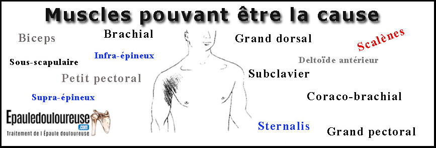 douleur avant épaule