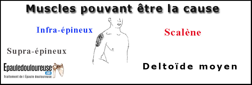 douleur du côté de l'épaule