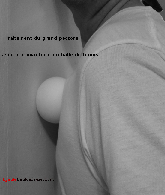 grand pectoral soulagement de la douleur