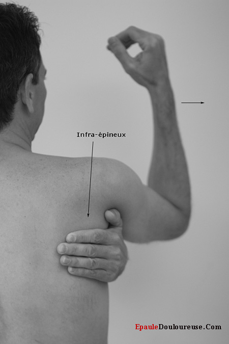 muscle infra-épineux