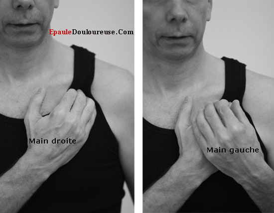 points trigger dans le petit pectoral