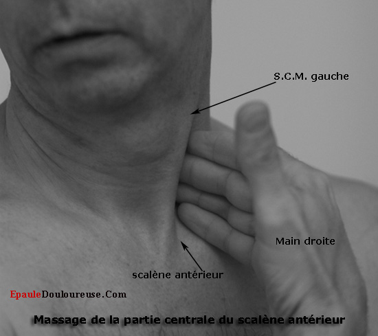 douleur cervicale