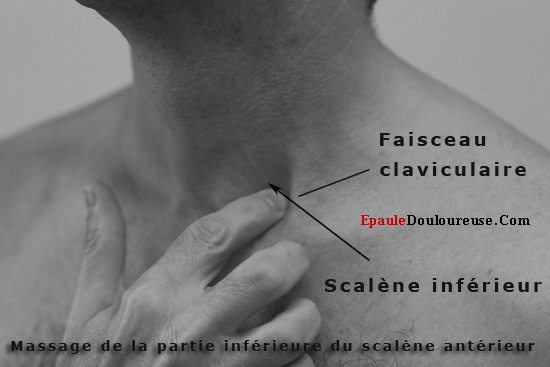 douleur cervicale