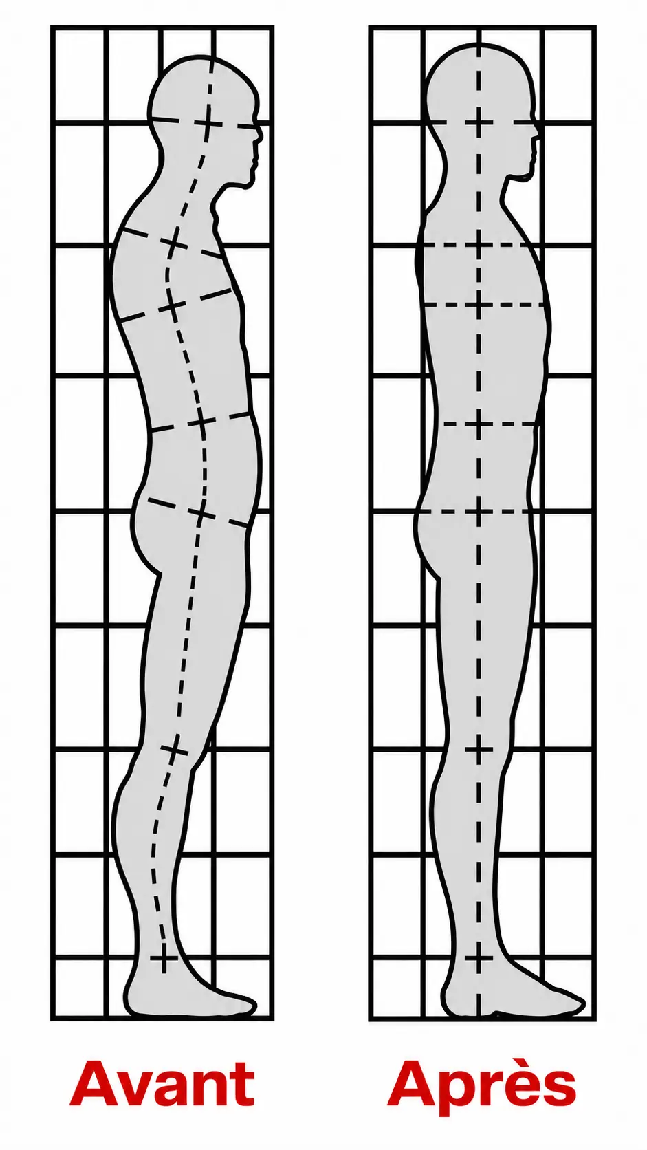 Illustration comparant la posture avant et après un processus postural