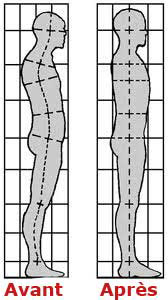 correction posturale