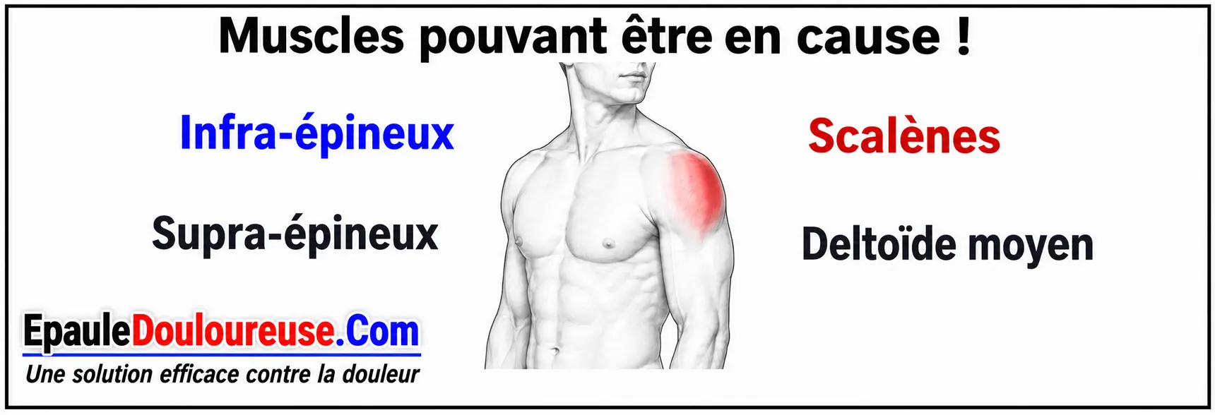Muscles pouvant contribuer à une douleur sur le côté de l’épaule