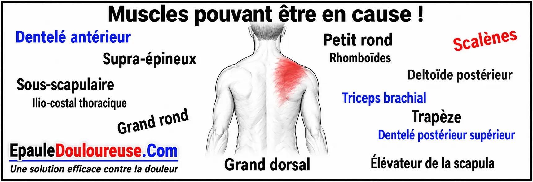 Muscles pouvant contribuer à une douleur à l’arrière de l’épaule