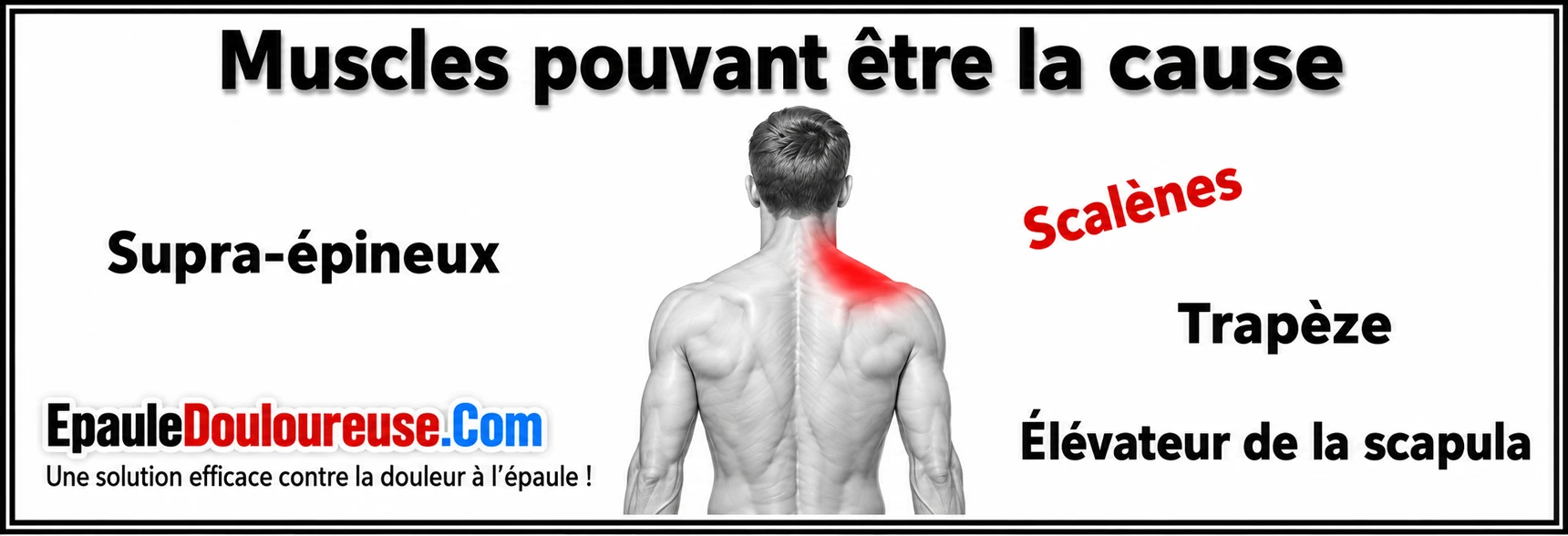 Muscles pouvant contribuer à une douleur sur le dessus de l’épaule