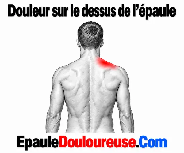 Douleur sur le dessus de l’épaule