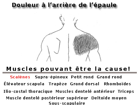 Douleur à l'arrière de l'épaule