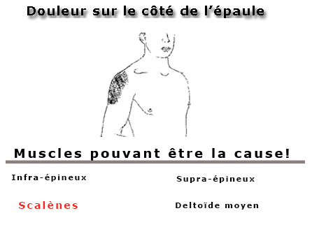 Douleur sur le côté de l'épaule