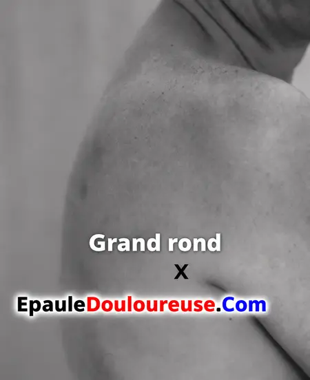 Emplacement du grand rond à l’arrière de l’aisselle