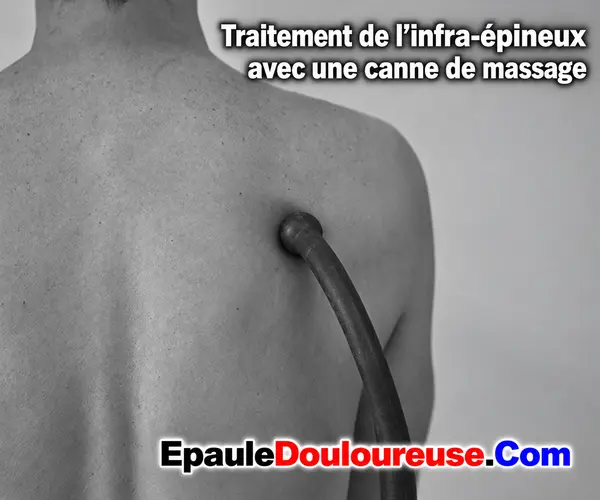 Étape 3 : désactivation des points trigger avec une canne de massage