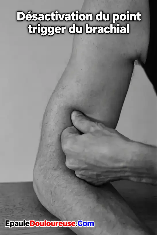 Technique d’automassage du muscle brachial
