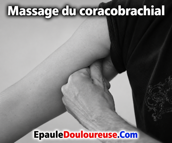 Technique d’auto-massage du muscle coracobrachial