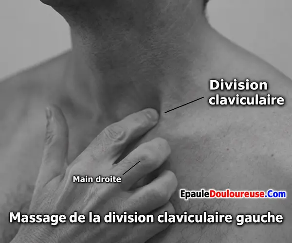Massage de la division claviculaire du SCM