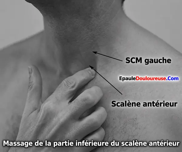 Massage de la partie inférieure du scalène antérieur
