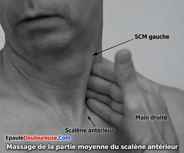 Massage de la partie moyenne du scalène antérieur