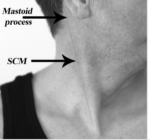neck myofascial release