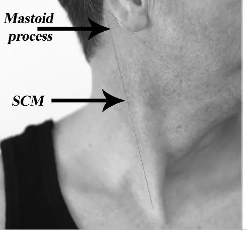 Localisation du processus mastoïde derrière l’oreille