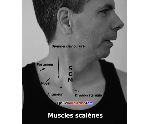 Emplacement des muscles scalènes