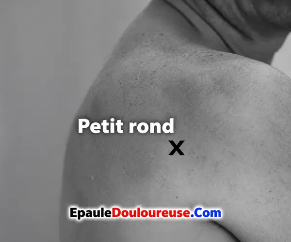 Emplacement du petit rond à l’arrière de l’épaule