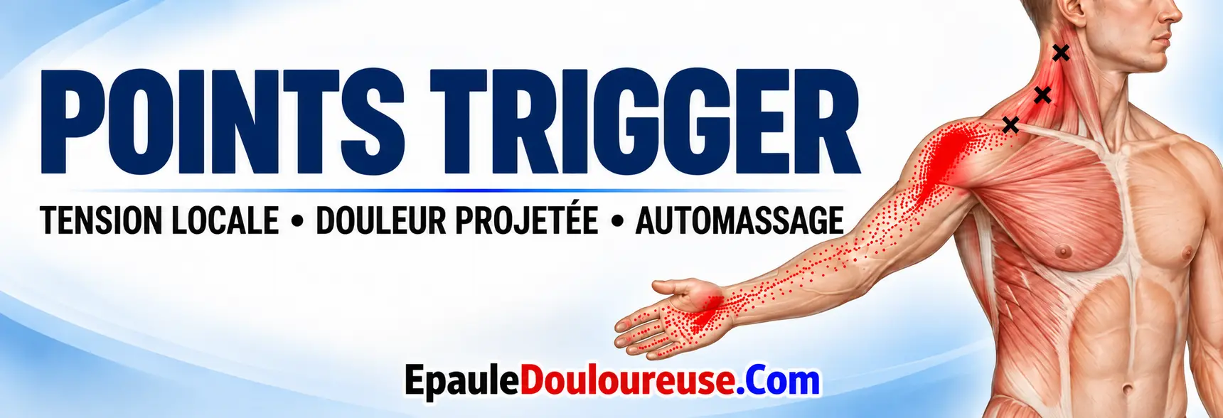 Bannière sur les points trigger et la douleur projetée
