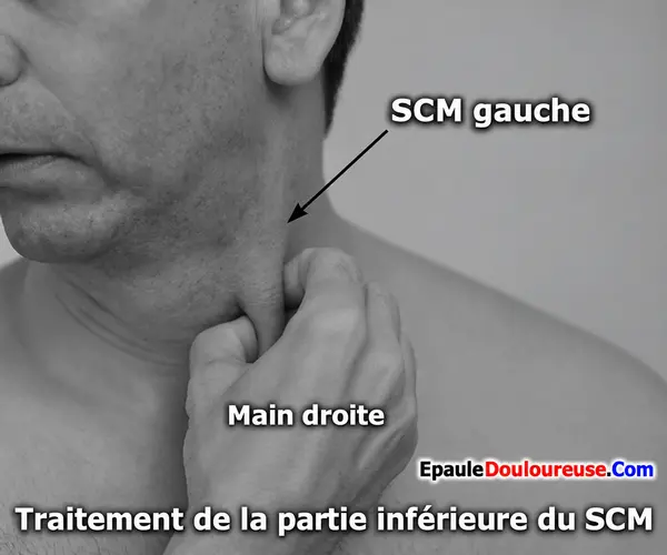 Massage de la partie inférieure de la division sternale du SCM