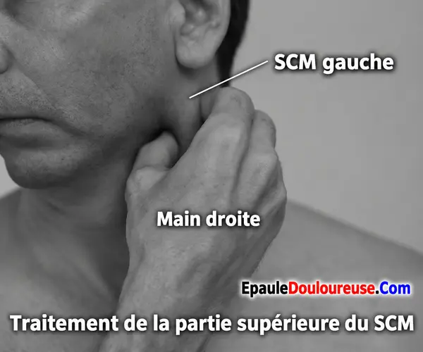 Massage de la partie supérieure de la division sternale du SCM
