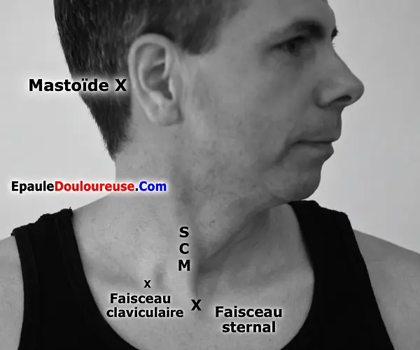 Emplacement du muscle sterno-cléido-mastoïdien