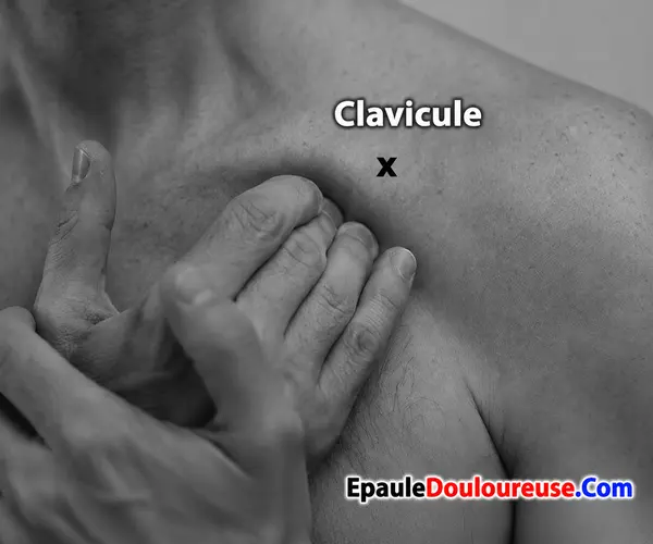 Technique d’auto-massage du subclavier